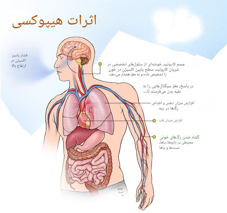 هیپوکسی چیست؟